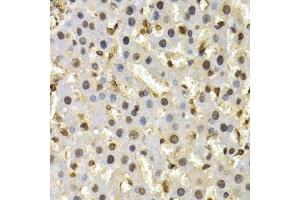 Immunohistochemistry of paraffin-embedded rat liver using CUL4B antibody (ABIN6130211, ABIN6139255, ABIN6139258 and ABIN6221048) at dilution of 1:200 (40x lens). (Cullin 4B antibody  (AA 1-200))