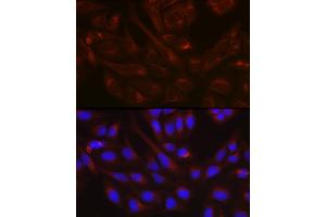 Immunofluorescence analysis of U-2 OS cells using NSF Rabbit pAb (ABIN6130571, ABIN6144871, ABIN6144872 and ABIN6214029) at dilution of 1:100 (40x lens). (NSF antibody  (AA 1-250))