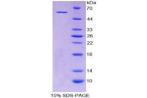 SDS-PAGE (SDS) image for Aldehyde Dehydrogenase 7 Family, Member A1 (ALDH7A1) (AA 1-539) protein (His tag) (ABIN1078758) (ALDH7A1 Protein (AA 1-539) (His tag))