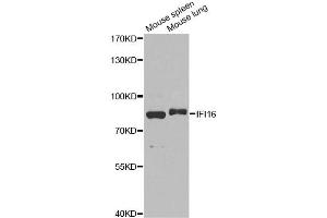 Western blot analysis of extracts of various cell lines, using IFI16 antibody. (IFI16 antibody)