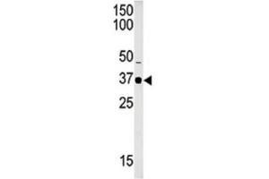 Western Blotting (WB) image for anti-SET Domain Containing 8 Pseudogene 1 (SETD8P1) antibody (ABIN2996452)