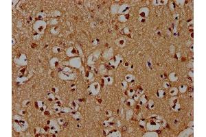 IHC image of ABIN7142212 diluted at 1:100 and staining in paraffin-embedded human brain tissue performed on a Leica BondTM system. (PSMD4/ASF antibody  (Regulatory Subunit 4))