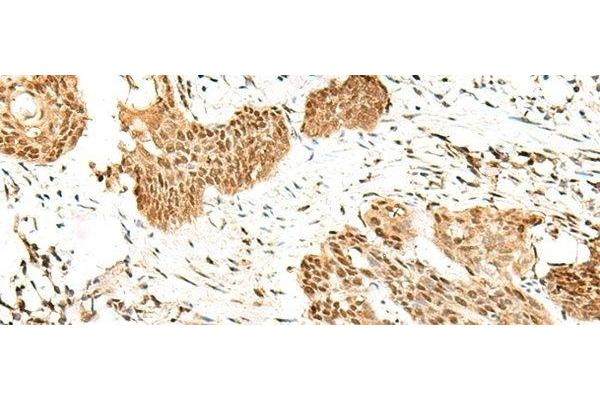 RBM19 antibody