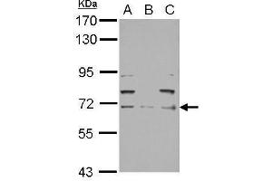 WB Image Sample (30 ug of whole cell lysate) A: PC-3 B: U87-MG C: SK-N-SH 7. (NEFL antibody)