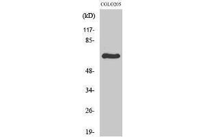 Western Blotting (WB) image for anti-Ribosomal Protein S6 Kinase, 70kDa, Polypeptide 1 (RPS6KB1) (Internal Region) antibody (ABIN3186301) (RPS6KB1 antibody  (Internal Region))
