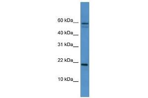 Hspb7 antibody used at 0. (HSPB7 antibody  (Middle Region))