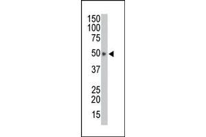 Image no. 1 for anti-HtrA Serine Peptidase 1 (HTRA1) (AA 389-419), (C-Term) antibody (ABIN356844) (HTRA1 antibody  (C-Term))