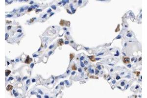 ABIN6267559 at 1/100 staining human lung tissue sections by IHC-P. (BCAR1 antibody  (pTyr410))