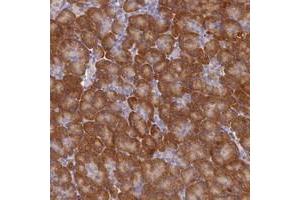 Immunohistochemical staining of human pancreas with ST7L polyclonal antibody  shows moderate cytoplasmic positivity in exocrine pancreas. (ST7L antibody)