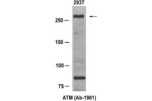 Image no. 1 for anti-Ataxia Telangiectasia Mutated (ATM) (Ser1981) antibody (ABIN319314) (ATM antibody  (Ser1981))