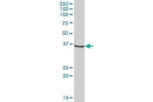 AKR1A1 MaxPab polyclonal antibody. (AKR1A1 antibody  (AA 1-325))
