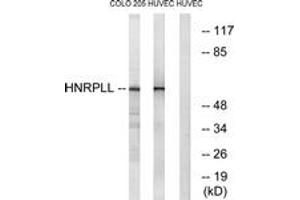 Western blot analysis of extracts from HuvEc/COLO cells, using HNRPLL Antibody. (HNRPLL antibody  (AA 241-290))