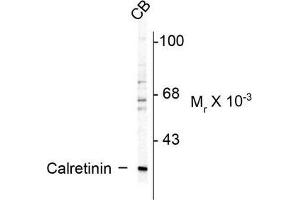 Image no. 1 for anti-Calbindin 2 (CALB2) antibody (ABIN372593) (Calretinin antibody)