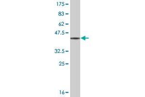 Western Blot detection against Immunogen (38. (GMPR antibody  (AA 1-120))