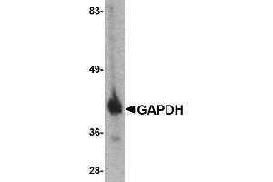 Western blot analysis of GAPDH in HeLa cell lysate with GAPDH antibody at 1 µg/mL. (GAPDH antibody  (C-Term))