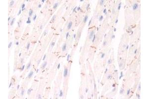 Detection of PIM1 in Mouse Cardiac Muscle Tissue using Polyclonal Antibody to Pim-1 Oncogene (PIM1) (PIM1 antibody  (AA 122-261))
