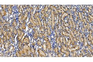Immunohistochemistry (IHC) image for anti-Receptor (TNFRSF)-Interacting serine-threonine Kinase 1 (RIPK1) (AA 1-179) antibody (ABIN7441205)