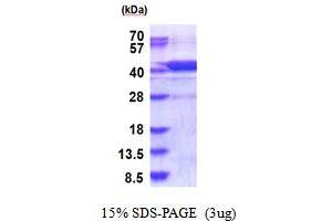SDS-PAGE (SDS) image for Aminoglycoside phosphotransferase Domain Containing 1 (AGPHD1) (AA 1-373) protein (His tag) (ABIN5853932)