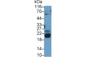 Detection of BNIP3 in Rat Skeletal muscle lysate using Polyclonal Antibody to Bcl2/Adenovirus E1B 19 kDa Interacting Protein 3 (BNIP3) (BNIP3 antibody  (AA 3-134))