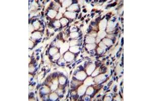 Immunohistochemistry analysis in formalin fixed and paraffin embedded human rectum tissue reacted with AP52225PU-N followed by peroxidase conjugation of the secondary antibody and DAB staining. (IQCA1 antibody  (C-Term))