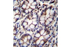 Immunohistochemistry analysis in formalin fixed and paraffin embedded human rectum tissue reacted with AP52225PU-N followed by peroxidase conjugation of the secondary antibody and DAB staining.