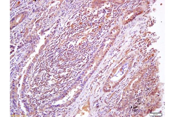 PRKAB1 antibody  (pSer182)