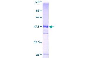 VBP1 Protein (AA 1-197) (GST tag)