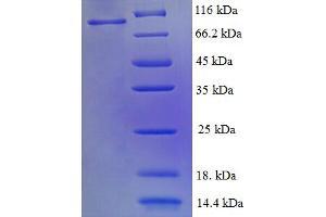 SDS-PAGE (SDS) image for Replication Protein A1, 70kDa (RPA1) (AA 2-616) protein (His-SUMO Tag) (ABIN5710272) (RPA1 Protein (AA 2-616) (His-SUMO Tag))