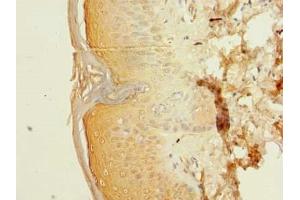 Immunohistochemistry of paraffin-embedded human skin tissue using ABIN7150462 at dilution of 1:100