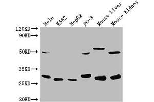 Western Blot Positive WB detected in: Hela whole cell lysate, K562 whole cell lysate, HepG2 whole cell lysate, PC-3 whole cell lysate, Mouse Liver tissue, Mouse Kidney tissue All lanes: NQO2 antibody at 1:2000 Secondary Goat polyclonal to rabbit IgG at 1/50000 dilution Predicted band size: 26 kDa Observed band size: 26 kDa (NQO2 antibody  (AA 1-231))