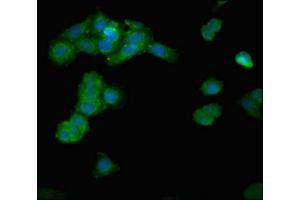 Immunofluorescent analysis of HepG2 cells using ABIN7143048 at dilution of 1:100 and Alexa Fluor 488-congugated AffiniPure Goat Anti-Rabbit IgG(H+L) (IPP antibody  (AA 444-515))