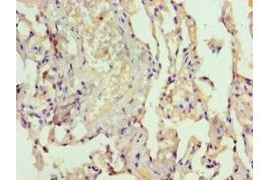 Immunohistochemistry of paraffin-embedded human lung tissue using ABIN7167072 at dilution of 1:100 (MAPKSP1 antibody  (AA 1-124))