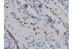 Immunohistochemistry (IHC) image for anti-Mannan-Binding Lectin Serine Peptidase 1 (MASP1) (AA 20-447) antibody (ABIN7434299)