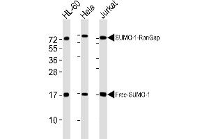 All lanes : Anti-SUMO1 Antibody at 1:4000 dilution Lane 1: HL-60 whole cell lysates Lane 2: Hela whole cell lysates Lane 3: Jurkat whole cell lysates Lysates/proteins at 20 μg per lane. (SUMO1 antibody)