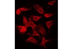 ABIN6275998 staining LOVO by IF/ICC. (GHRHR antibody  (C-Term))