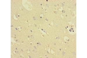 Immunohistochemistry of paraffin-embedded human brain tissue using ABIN7172006 at dilution of 1:100 (TXNDC8 antibody  (AA 1-115))
