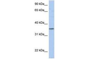 Image no. 1 for anti-Proline Rich 18 (PRR18) (AA 35-84) antibody (ABIN6743875) (Proline Rich 18 antibody  (AA 35-84))