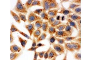 ICC testing of HeLa cells (HSD17B1 antibody  (AA 29-43))