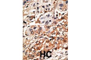 Immunohistochemistry (IHC) image for anti-Bcl2 Modifying Factor (BMF) (BH3 Domain) antibody (ABIN2997142) (BMF antibody  (BH3 Domain))