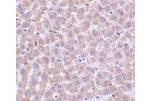 Immunohistochemistry of TIP47 in rat liver tissue with this product at 2 μg/ml. (PLIN3 antibody  (N-Term))