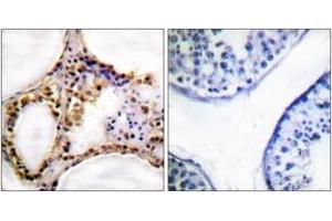 Immunohistochemistry analysis of paraffin-embedded human testis, using RAD52 (Phospho-Tyr104) Antibody. (RAD52 antibody  (pTyr104))