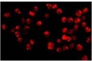 Immunofluorescence of Acinus in K562 cells with with Acinusat 20 µg/ml.