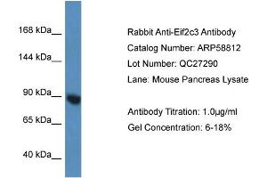 Western Blotting (WB) image for anti-Eukaryotic Translation Initiation Factor 2C3 (EIF2C3) (N-Term) antibody (ABIN2787837)