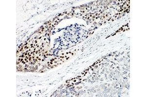 Immunohistochemistry (IHC) image for anti-T-Complex 1 (TCP1) (AA 82-98) antibody (ABIN3029087)