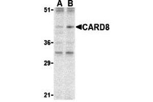 Western Blotting (WB) image for anti-Caspase Recruitment Domain Family, Member 8 (CARD8) (C-Term) antibody (ABIN1030312) (CARD8 antibody  (C-Term))