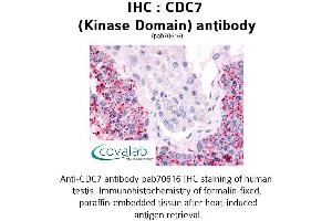Image no. 1 for anti-Cell Division Cycle 7 (CDC7) antibody (ABIN1732914) (CDC7 antibody)