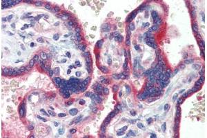 Human Placenta (formalin-fixed, paraffin-embedded) stained with ZNF165 antibody ABIN462198 followed by biotinylated goat anti-rabbit IgG secondary antibody ABIN481713, alkaline phosphatase-streptavidin and chromogen. (ZNF165 antibody  (AA 216-265))