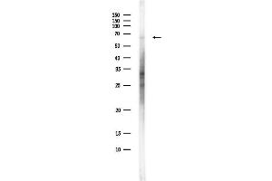anti-Acyl-CoA Oxidase 3, Pristanoyl (ACOX3) (Internal Region) antibody