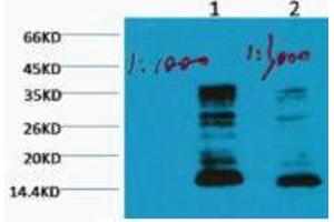 Western Blot (WB) analysis of HeLa, diluted at 1) 1:1000, 2) 1:3000.