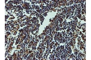 Immunoperoxidase of monoclonal antibody to CREB1 on formalin-fixed paraffin-embedded human lymph node tissue. (CREB1 antibody  (AA 1-341))